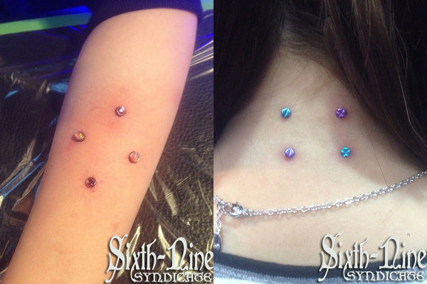 あらゆる部位に施術可能